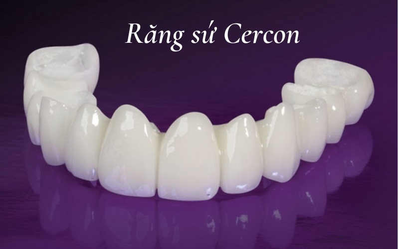 Răng sứ Cercon có chất lượng không Giá hiện nay là bao nhiêu