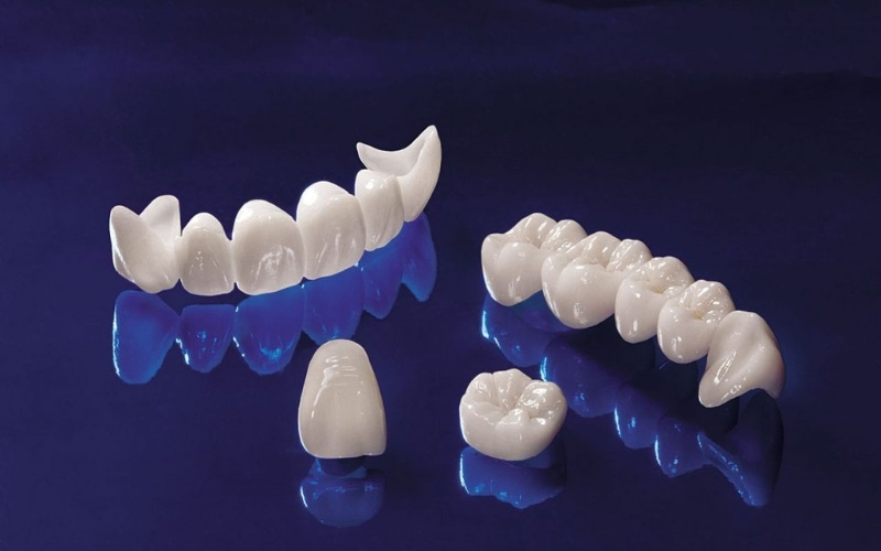 Răng sứ Cercon HT là dòng sứ được cải tiến, cao cấp hơn răng Cercon Zirconia
