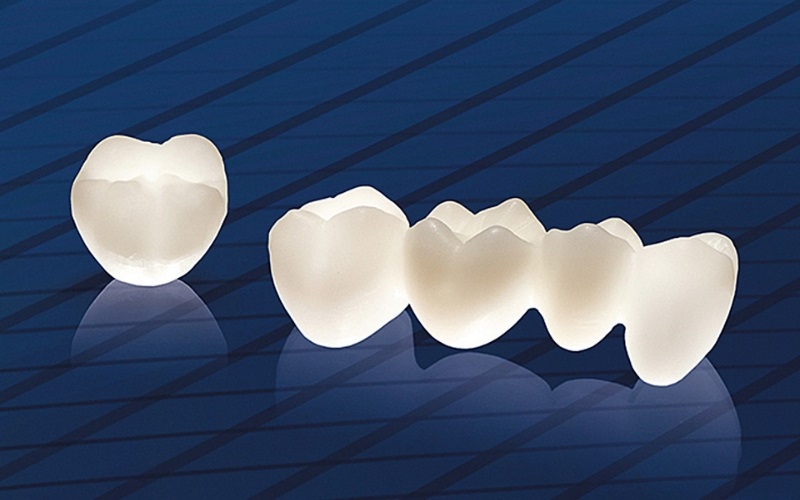 Răng sứ Cercon là một trong những dòng răng toàn sứ chất lượng nhất hiện nay