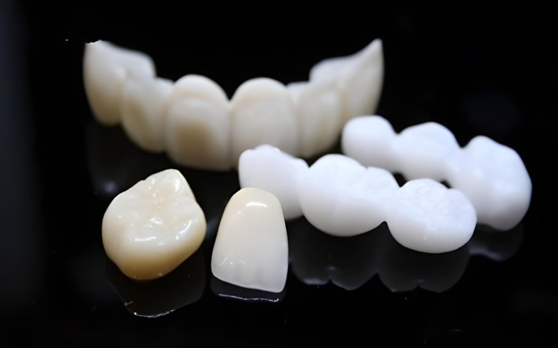 Răng sứ không kim loại Cercon đa dạng, phong phú về tông màu mang đến nhiều sự lựa chọn cho khách hàng